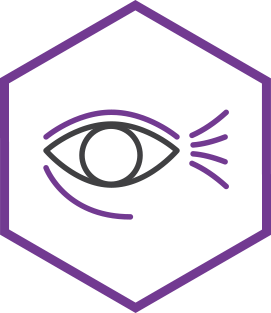 Periorbital wrinkles